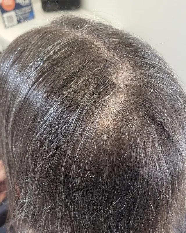 Before — thinning at the crown