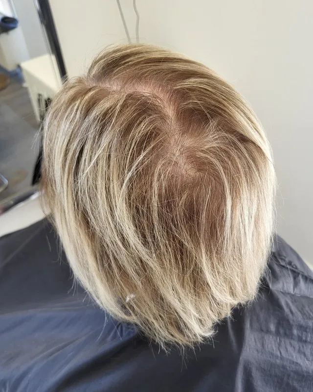 Before — visible scalp at the crown