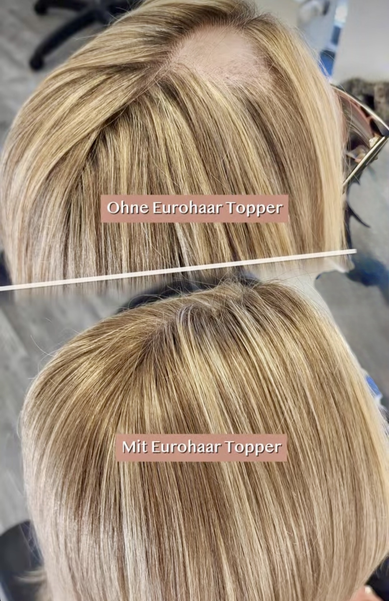 The same crown photographed before and after a HEADS European hair topper