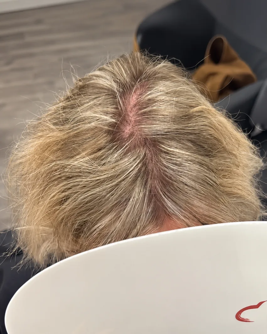Before — thinning blonde parting seen from above, HEADS studio